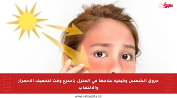حروق الشمس وكيفية علاجها في المنزل بأسرع وقت لتخفيف الاحمرار والالتهاب